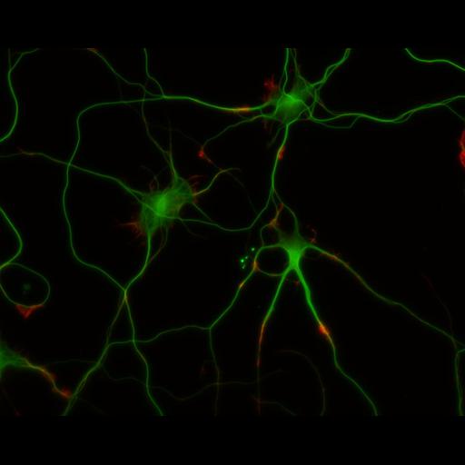  NCBI Organism:Rattus; Cell Types:multipolar neuron Cell Components:cytoskeleton, microtubule cytoskeleton, actin cytoskeleton, axon, dendrite, dendritic growth cone, axonal growth cone, lamellipodium, filopodium; Biological process:developmental process, dendrite development, establishment or maintenance of cell polarity;