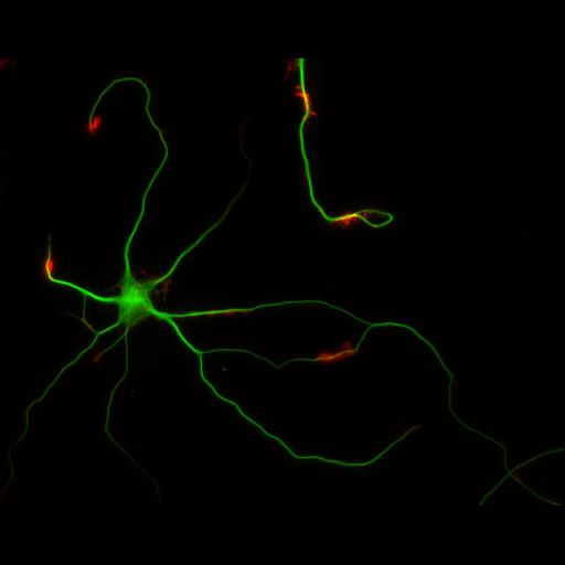  NCBI Organism:Rattus; Cell Types:multipolar neuron Cell Components:cytoskeleton, microtubule cytoskeleton, actin cytoskeleton, axon, dendrite, dendritic growth cone, axonal growth cone, lamellipodium, filopodium; Biological process:developmental process, dendrite development, establishment or maintenance of cell polarity;