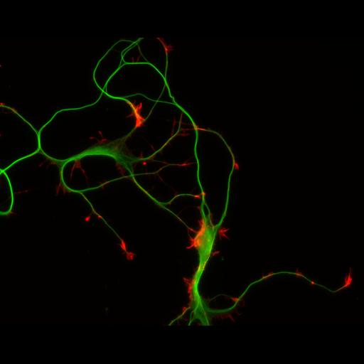  NCBI Organism:Rattus; Cell Types:multipolar neuron Cell Components:cytoskeleton, microtubule cytoskeleton, actin cytoskeleton, axon, dendrite, dendritic growth cone, axonal growth cone, lamellipodium, filopodium; Biological process:developmental process, dendrite development, establishment or maintenance of cell polarity;