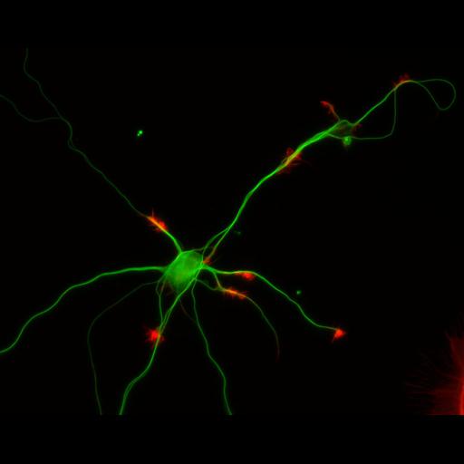  NCBI Organism:Rattus; Cell Types:multipolar neuron Cell Components:cytoskeleton, microtubule cytoskeleton, actin cytoskeleton, axon, dendrite, dendritic growth cone, axonal growth cone, lamellipodium, filopodium; Biological process:developmental process, dendrite development, establishment or maintenance of cell polarity;