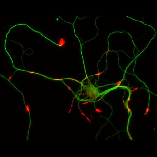  NCBI Organism:Rattus; Cell Types:multipolar neuron Cell Components:cytoskeleton, microtubule cytoskeleton, actin cytoskeleton, axon, dendrite, dendritic growth cone, axonal growth cone, lamellipodium, filopodium; Biological process:developmental process, dendrite development, establishment or maintenance of cell polarity;