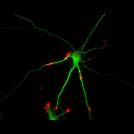  NCBI Organism:Rattus; Cell Types:multipolar neuron Cell Components:cytoskeleton, microtubule cytoskeleton, actin cytoskeleton, axon, dendrite, dendritic growth cone, axonal growth cone, lamellipodium, filopodium; Biological process:developmental process, dendrite development, establishment or maintenance of cell polarity;