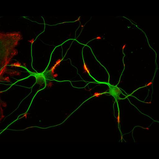  NCBI Organism:Rattus; Cell Types:multipolar neuron Cell Components:cytoskeleton, microtubule cytoskeleton, actin cytoskeleton, axon, dendrite, dendritic growth cone, axonal growth cone, lamellipodium, filopodium; Biological process:developmental process, dendrite development, establishment or maintenance of cell polarity;