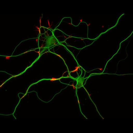  NCBI Organism:Rattus; Cell Types:multipolar neuron Cell Components:cytoskeleton, microtubule cytoskeleton, actin cytoskeleton, axon, dendrite, dendritic growth cone, axonal growth cone, lamellipodium, filopodium; Biological process:developmental process, dendrite development, establishment or maintenance of cell polarity;