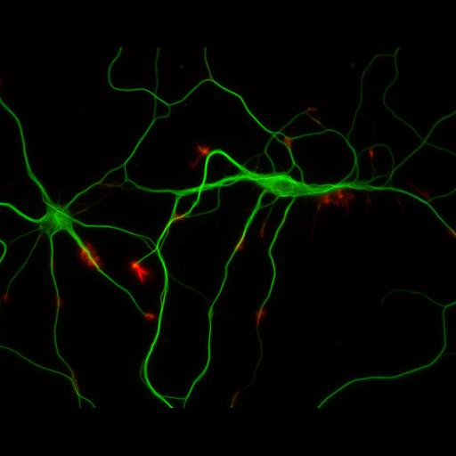  NCBI Organism:Rattus; Cell Types:multipolar neuron Cell Components:cytoskeleton, microtubule cytoskeleton, actin cytoskeleton, axon, dendrite, dendritic growth cone, axonal growth cone, lamellipodium, filopodium; Biological process:developmental process, dendrite development, establishment or maintenance of cell polarity;