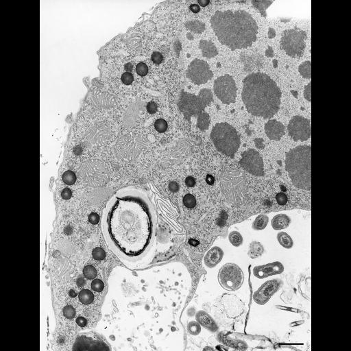  NCBI Organism:Halteria grandinella; Cell Types:cell by organism, eukaryotic cell, , ; Cell Components:macronucleus, pigment granule, food vacuole; Biological process:macronucleus organization, cellular pigmentation, digestion;