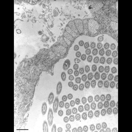  NCBI Organism:Halteria grandinella; Cell Types:cell by organism, eukaryotic cell, , ; Cell Components:cilium axoneme, , food vacuole; Biological process:ciliary or flagellar motility, digestion, ;