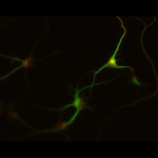  NCBI Organism:Rattus; Cell Types:multipolar neuron Cell Components:dendrite, microtubule cytoskeleton, synapse part; Biological process:cellular developmental process, dendrite development, establishment or maintenance of cell polarity, synapse assembly, protein localization to synapse;