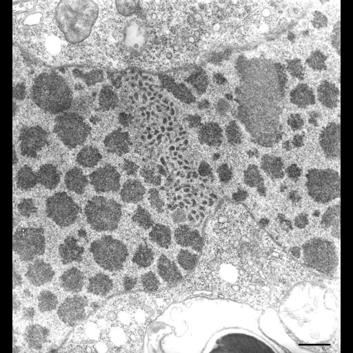  NCBI Organism:Halteria grandinella; Cell Types:cell by organism, eukaryotic cell, , ; Cell Components:macronucleus, nucleolus; Biological process:DNA replication checkpoint, nucleus organization;