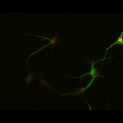  NCBI Organism:Rattus; Cell Types:multipolar neuron Cell Components:dendrite, microtubule cytoskeleton, synapse part; Biological process:cellular developmental process, dendrite development, establishment or maintenance of cell polarity, synapse assembly, protein localization to synapse;