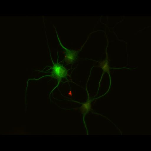  NCBI Organism:Rattus; Cell Types:multipolar neuron Cell Components:dendrite, microtubule cytoskeleton, synapse part; Biological process:cellular developmental process, dendrite development, establishment or maintenance of cell polarity, synapse assembly, protein localization to synapse;