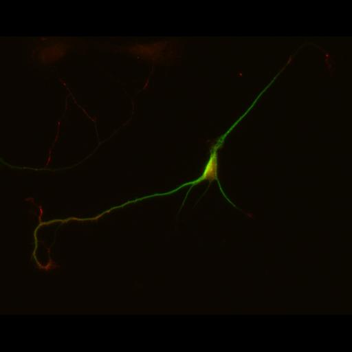  NCBI Organism:Rattus; Cell Types:multipolar neuron Cell Components:dendrite, microtubule cytoskeleton, synapse part; Biological process:cellular developmental process, dendrite development, establishment or maintenance of cell polarity, synapse assembly, protein localization to synapse;