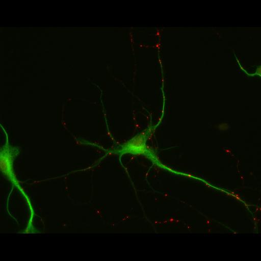  NCBI Organism:Rattus; Cell Types:multipolar neuron Cell Components:dendrite, microtubule cytoskeleton, synapse part; Biological process:cellular developmental process, dendrite development, establishment or maintenance of cell polarity, synapse assembly, protein localization to synapse;