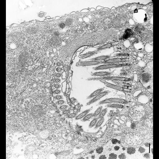  NCBI Organism:Halteria grandinella; Cell Types:cell by organism, eukaryotic cell, , ; Cell Components:oral apparatus, cytoskeleton, ciliary rootlet; Biological process:response to food, cytoskeleton organization;