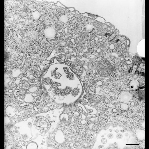  NCBI Organism:Halteria grandinella; Cell Types:cell by organism, eukaryotic cell, , ; Cell Components:, , cortical microtubule cytoskeleton; Biological process:digestion, , cytoskeleton organization;