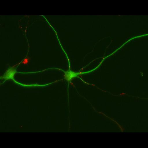  NCBI Organism:Rattus; Cell Types:multipolar neuron Cell Components:dendrite, microtubule cytoskeleton, synapse part; Biological process:cellular developmental process, dendrite development, establishment or maintenance of cell polarity, synapse assembly, protein localization to synapse;