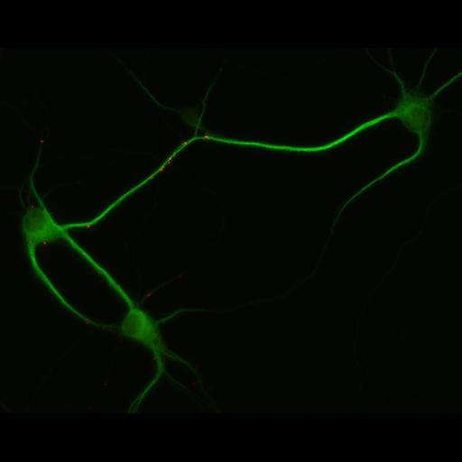  NCBI Organism:Rattus; Cell Types:multipolar neuron Cell Components:dendrite, microtubule cytoskeleton, synapse part; Biological process:cellular developmental process, dendrite development, establishment or maintenance of cell polarity, synapse assembly, protein localization to synapse;