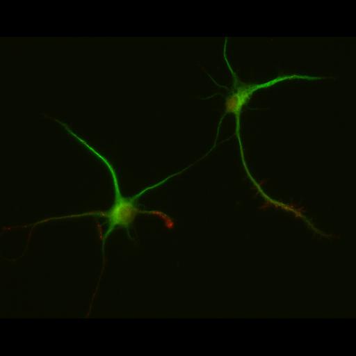  NCBI Organism:Rattus; Cell Types:multipolar neuron Cell Components:dendrite, microtubule cytoskeleton, synapse part; Biological process:cellular developmental process, dendrite development, establishment or maintenance of cell polarity, synapse assembly, protein localization to synapse;