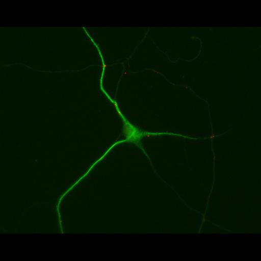  NCBI Organism:Rattus; Cell Types:multipolar neuron Cell Components:dendrite, microtubule cytoskeleton, synapse part; Biological process:cellular developmental process, dendrite development, establishment or maintenance of cell polarity, synapse assembly, protein localization to synapse;