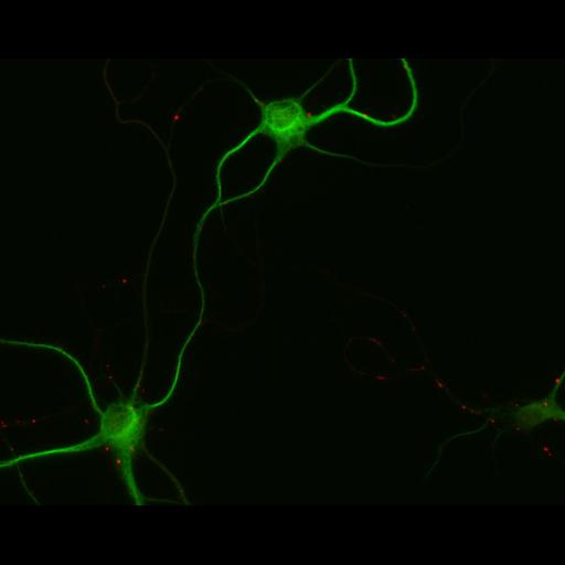  NCBI Organism:Rattus; Cell Types:multipolar neuron Cell Components:dendrite, microtubule cytoskeleton, synapse part; Biological process:cellular developmental process, dendrite development, establishment or maintenance of cell polarity, synapse assembly, protein localization to synapse;