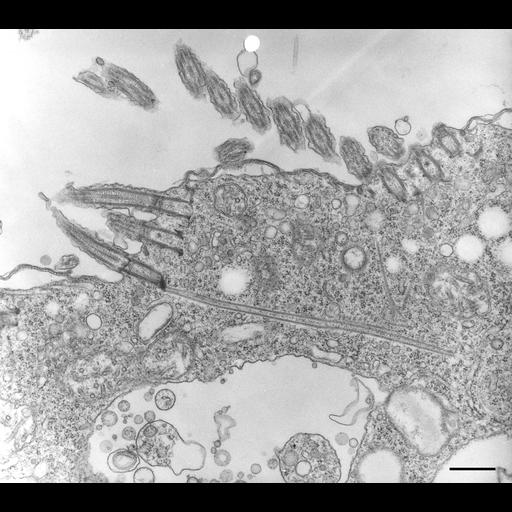  NCBI Organism:Halteria grandinella; Cell Types:cell by organism, eukaryotic cell, , ; Cell Components:microtubule basal body, microtubule cytoskeleton; Biological process:microtubule cytoskeleton organization, microtubule bundle formation, microtubule basal body organization;