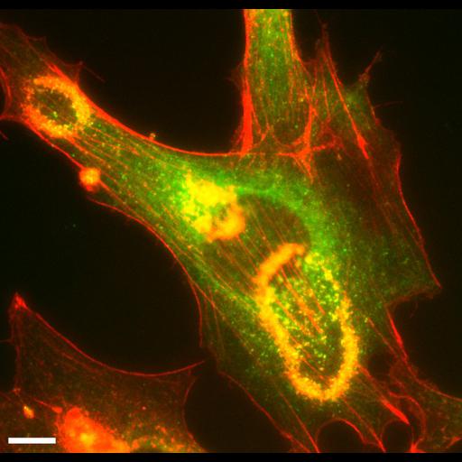  NCBI Organism:Mus musculus; Cell Types:fibroblast Cell Components:, actin cytoskeleton, ; Biological process:platelet-derived growth factor receptor signaling pathway, pinocytosis;