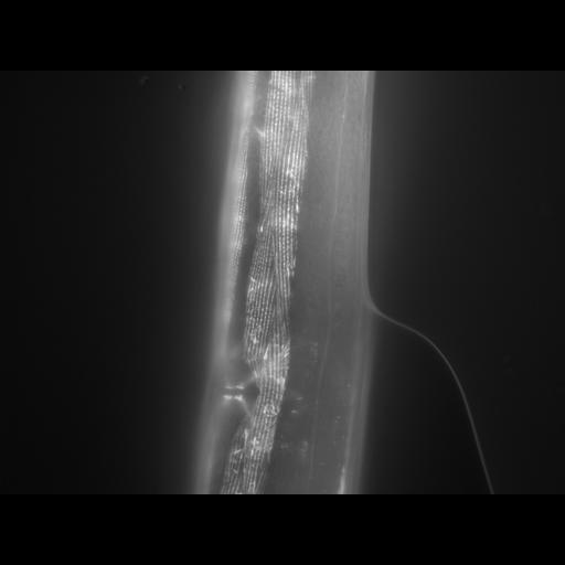  NCBI Organism:Caenorhabditis elegans; Cell Types:muscle cell Cell Components:actin filament Biological process:chronological cell aging