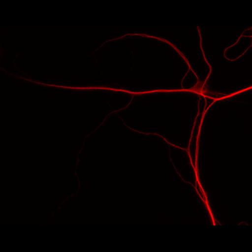  NCBI Organism:Rattus; Cell Types:multipolar neuron Cell Components:dendrite, microtubule cytoskeleton, synapse part; Biological process:cellular developmental process, dendrite development, establishment or maintenance of cell polarity, synapse assembly, protein localization to synapse;