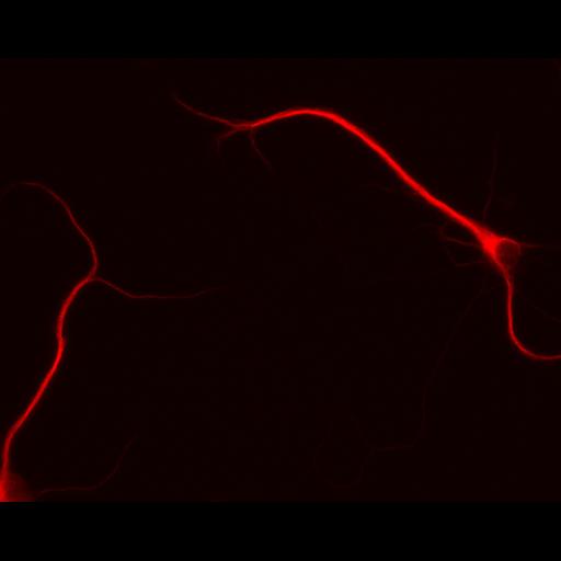  NCBI Organism:Rattus; Cell Types:multipolar neuron Cell Components:dendrite, microtubule cytoskeleton, synapse part; Biological process:cellular developmental process, dendrite development, establishment or maintenance of cell polarity, synapse assembly, protein localization to synapse;