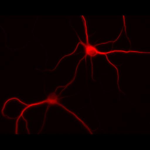  NCBI Organism:Rattus; Cell Types:multipolar neuron Cell Components:dendrite, microtubule cytoskeleton, synapse part; Biological process:cellular developmental process, dendrite development, establishment or maintenance of cell polarity, synapse assembly, protein localization to synapse;