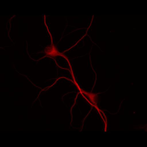  NCBI Organism:Rattus; Cell Types:multipolar neuron Cell Components:dendrite, microtubule cytoskeleton, synapse part; Biological process:cellular developmental process, dendrite development, establishment or maintenance of cell polarity, synapse assembly, protein localization to synapse;