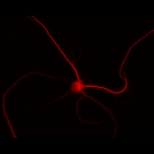  NCBI Organism:Rattus; Cell Types:multipolar neuron Cell Components:dendrite, microtubule cytoskeleton, synapse part; Biological process:cellular developmental process, dendrite development, establishment or maintenance of cell polarity, synapse assembly, protein localization to synapse;