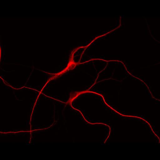  NCBI Organism:Rattus; Cell Types:multipolar neuron Cell Components:dendrite, microtubule cytoskeleton, synapse part; Biological process:cellular developmental process, dendrite development, establishment or maintenance of cell polarity, synapse assembly, protein localization to synapse;