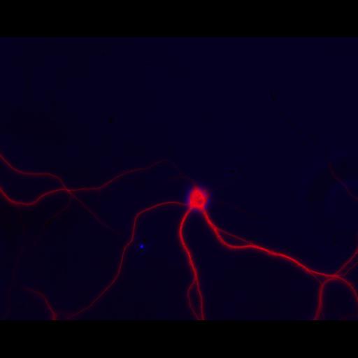  NCBI Organism:Rattus; Cell Types:multipolar neuron Cell Components:dendrite, microtubule cytoskeleton, synapse part; Biological process:cellular developmental process, dendrite development, establishment or maintenance of cell polarity, synapse assembly, protein localization to synapse;