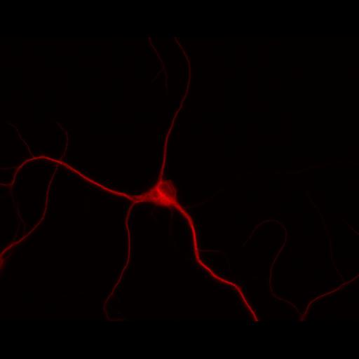  NCBI Organism:Rattus; Cell Types:multipolar neuron Cell Components:dendrite, microtubule cytoskeleton, synapse part; Biological process:cellular developmental process, dendrite development, establishment or maintenance of cell polarity, synapse assembly, protein localization to synapse;