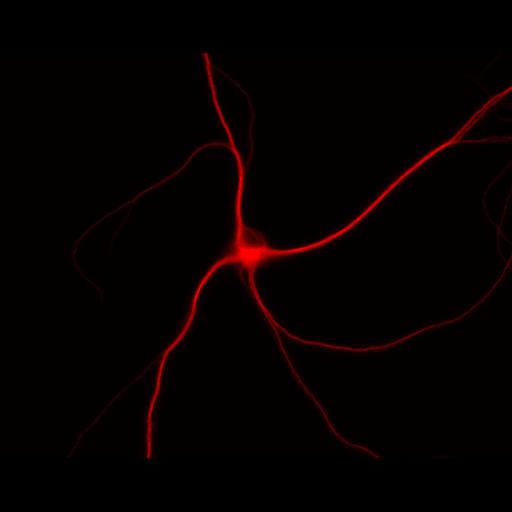  NCBI Organism:Rattus; Cell Types:multipolar neuron Cell Components:dendrite, microtubule cytoskeleton, synapse part; Biological process:cellular developmental process, dendrite development, establishment or maintenance of cell polarity, synapse assembly, protein localization to synapse;