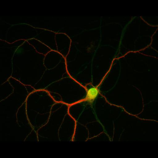  NCBI Organism:Rattus; Cell Types:multipolar neuron Cell Components:dendrite, microtubule cytoskeleton, synapse part; Biological process:cellular developmental process, dendrite development, establishment or maintenance of cell polarity, synapse assembly, protein localization to synapse;