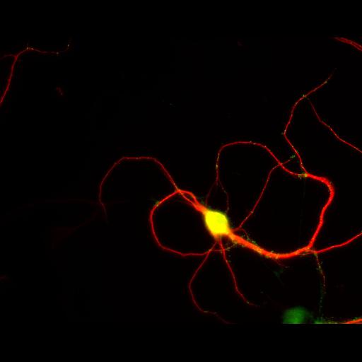  NCBI Organism:Rattus; Cell Types:multipolar neuron Cell Components:dendrite, microtubule cytoskeleton, synapse part; Biological process:cellular developmental process, dendrite development, establishment or maintenance of cell polarity, synapse assembly, protein localization to synapse;