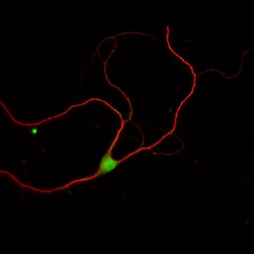  NCBI Organism:Rattus; Cell Types:multipolar neuron Cell Components:dendrite, microtubule cytoskeleton, synapse part; Biological process:cellular developmental process, dendrite development, establishment or maintenance of cell polarity, synapse assembly, protein localization to synapse;