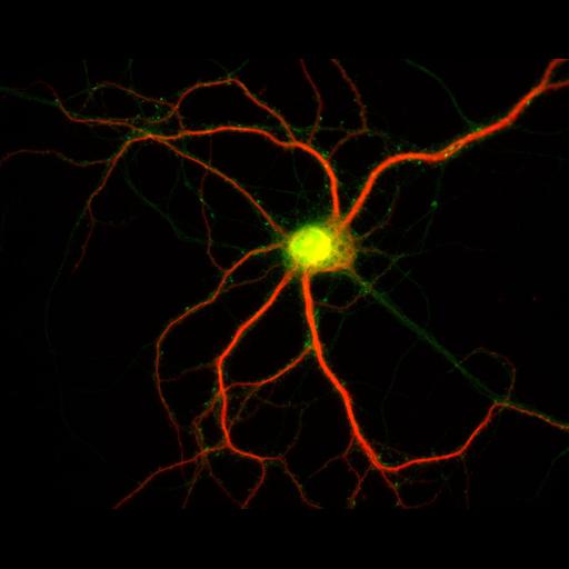  NCBI Organism:Rattus; Cell Types:multipolar neuron Cell Components:dendrite, microtubule cytoskeleton, synapse part; Biological process:cellular developmental process, dendrite development, establishment or maintenance of cell polarity, synapse assembly, protein localization to synapse;