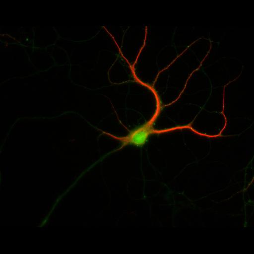  NCBI Organism:Rattus; Cell Types:multipolar neuron Cell Components:dendrite, microtubule cytoskeleton, synapse part; Biological process:cellular developmental process, dendrite development, establishment or maintenance of cell polarity, synapse assembly, protein localization to synapse;