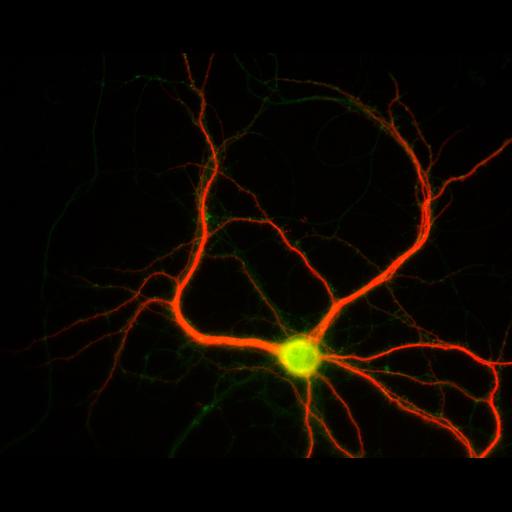  NCBI Organism:Rattus; Cell Types:multipolar neuron Cell Components:dendrite, microtubule cytoskeleton, synapse part; Biological process:cellular developmental process, dendrite development, establishment or maintenance of cell polarity, synapse assembly, protein localization to synapse;