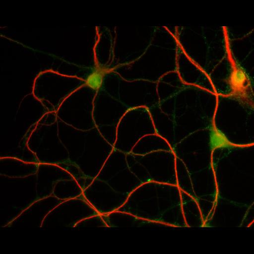  NCBI Organism:Rattus; Cell Types:multipolar neuron Cell Components:dendrite, microtubule cytoskeleton, synapse part; Biological process:cellular developmental process, dendrite development, establishment or maintenance of cell polarity, synapse assembly, protein localization to synapse;