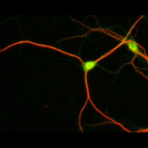  NCBI Organism:Rattus; Cell Types:multipolar neuron Cell Components:dendrite, microtubule cytoskeleton, synapse part; Biological process:cellular developmental process, dendrite development, establishment or maintenance of cell polarity, synapse assembly, protein localization to synapse;