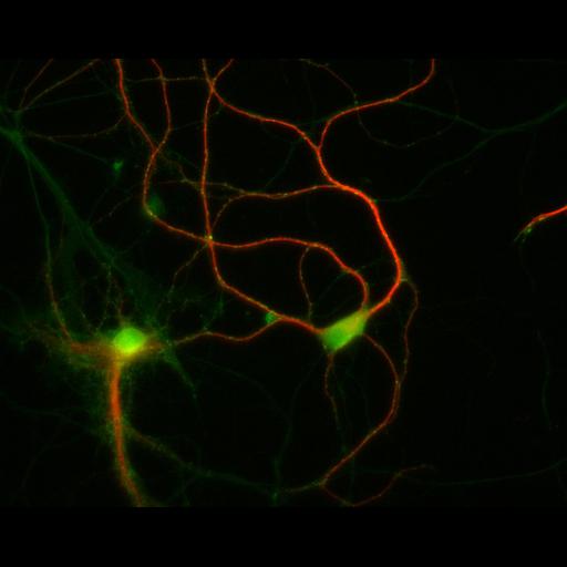  NCBI Organism:Rattus; Cell Types:multipolar neuron Cell Components:dendrite, microtubule cytoskeleton, synapse part; Biological process:cellular developmental process, dendrite development, establishment or maintenance of cell polarity, synapse assembly, protein localization to synapse;