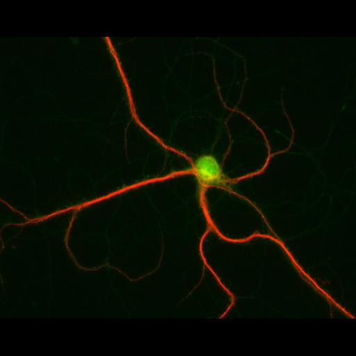  NCBI Organism:Rattus; Cell Types:multipolar neuron Cell Components:dendrite, microtubule cytoskeleton, synapse part; Biological process:cellular developmental process, dendrite development, establishment or maintenance of cell polarity, synapse assembly, protein localization to synapse;