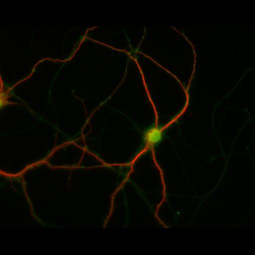  NCBI Organism:Rattus; Cell Types:multipolar neuron Cell Components:dendrite, microtubule cytoskeleton, synapse part; Biological process:cellular developmental process, dendrite development, establishment or maintenance of cell polarity, synapse assembly, protein localization to synapse;