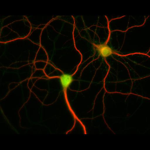  NCBI Organism:Rattus; Cell Types:multipolar neuron Cell Components:dendrite, microtubule cytoskeleton, synapse part; Biological process:cellular developmental process, dendrite development, establishment or maintenance of cell polarity, synapse assembly, protein localization to synapse;