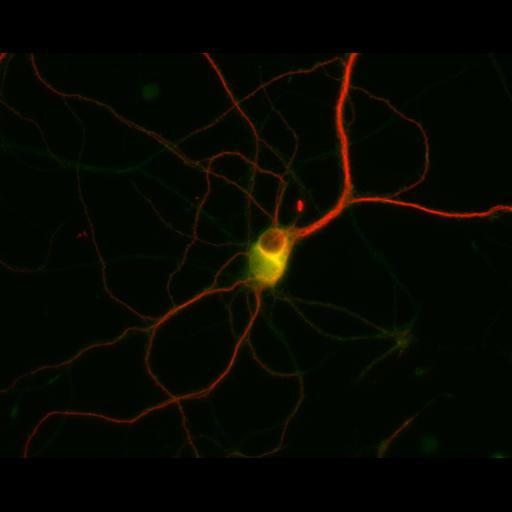  NCBI Organism:Rattus; Cell Types:multipolar neuron Cell Components:dendrite, microtubule cytoskeleton, synapse part; Biological process:cellular developmental process, dendrite development, establishment or maintenance of cell polarity, synapse assembly, protein localization to synapse;