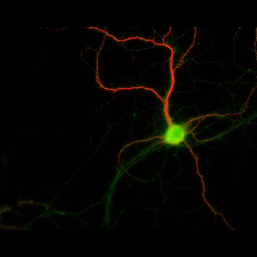  NCBI Organism:Rattus; Cell Types:multipolar neuron Cell Components:dendrite, microtubule cytoskeleton, synapse part; Biological process:cellular developmental process, dendrite development, establishment or maintenance of cell polarity, synapse assembly, protein localization to synapse;